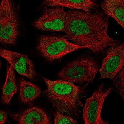 Immunocytochemistry/Immunofluorescence: RBM3 Antibody (CL0296) [NBP2-52906] - Staining of U-2 OS cells using the anti-RBM3 monoclonal antibody, showing specific staining in the nucleoplasm in green. Microtubule- and nuclear probes are visualized in red and blue, respectively (where available). Antibody staining is shown in green.