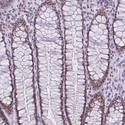 Immunohistochemistry-Paraffin: RBM3 Antibody (CL0296) [NBP2-52906] - Staining of human rectum shows moderate nuclear positivity in glandular cells.