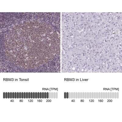 Immunohistochemistry-Paraffin: RBM3 Antibody (CL0296) [NBP2-52906] - Staining in human tonsil and liver tissues. Corresponding RBM3 RNA-seq data are presented for the same tissues.