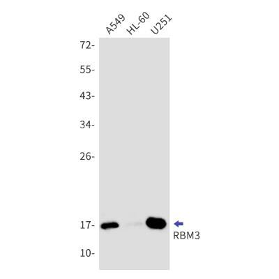 Western Blot: RBM3 Antibody (S02-0C1) [NBP3-19912] - Western blot detection of RBM3 in A549, HL-60, U251 cell lysates using NBP3-19912 (1:1000 diluted). Predicted band size: 17kDa. Observed band size: 17kDa.