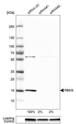 Western Blot: RBM3 Antibody [NBP1-81580] - Analysis in U-251MG cells transfected with control siRNA, target specific siRNA probe #1 and #2. Remaining relative intensity is presented. Loading control: Anti-GAPDH.