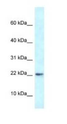 Western Blot: RBM3 Antibody [NBP1-82410] - Titration: 1.0 ug/ml Positive Control: Rat Lung.