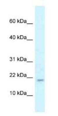 Western Blot: RBM3 Antibody [NBP1-82411] - Mouse Liver Lysate 1ug/ml Gel Concentration 10-20%