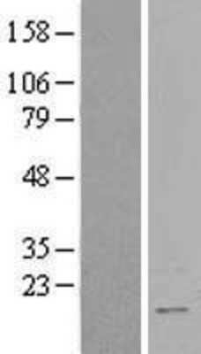 Western Blot: RBM3 Overexpression Lysate (Adult Normal) [NBL1-15205] Left-Empty vector transfected control cell lysate (HEK293 cell lysate); Right -Over-expression Lysate for RBM3.