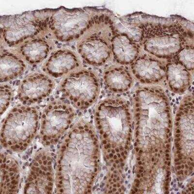 Immunohistochemistry-Paraffin: RBM42 Antibody [NBP1-82770] - Staining of human stomach, upper shows strong nuclear positivity in glandular cells.
