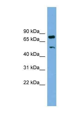 Western Blot: RBM42 Antibody [NBP1-57523] - HepG2 cell lysate, concentration 0.2-1 ug/ml.
