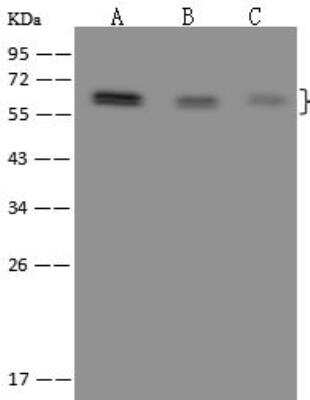 Western Blot: RBM42 Antibody [NBP3-12649] - Lane A: HeLa Whole Cell LysateLane B: Jurkat Whole Cell LysateLane C: NIH/3T3 Whole Cell LysateLysates/proteins at 30 ug per lane.SecondaryGoat Anti-Rabbit IgG (H+L)/HRP at 1/10000 dilution.Developed using the ECL technique.Performed under reducing conditions.Predicted band size:50 kDaObserved band size: kDa