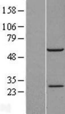 Western Blot: RBM42 Overexpression Lysate (Adult Normal) [NBL1-15212] Left-Empty vector transfected control cell lysate (HEK293 cell lysate); Right -Over-expression Lysate for RBM42.