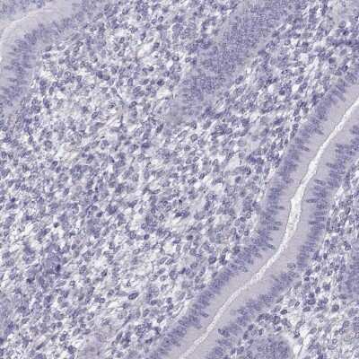 Immunohistochemistry-Paraffin RBM44 Antibody