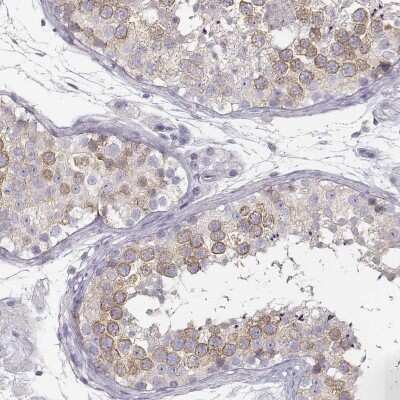 Immunohistochemistry-Paraffin RBM44 Antibody