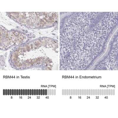 Immunohistochemistry-Paraffin RBM44 Antibody