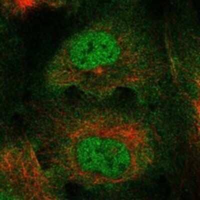 Immunocytochemistry/Immunofluorescence: RBM46 Antibody [NBP3-17424] - Staining of human cell line U-2 OS shows localization to nucleoplasm, plasma membrane & cytosol.