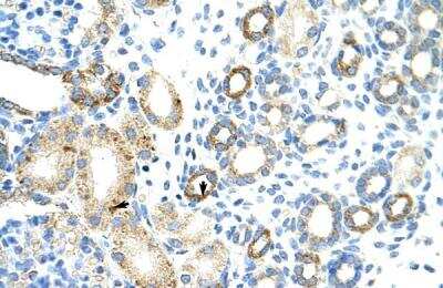 Immunohistochemistry-Paraffin: RBM46 Antibody [NBP1-80475] - Human kidney Tissue, antibody concentration 4-8ug/ml. Cells with positive label: renal corpuscle cells (indicated with arrows) 400X magnification.