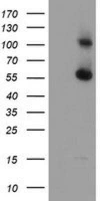 Western Blot: RBM46 Antibody (OTI1D6) - Azide and BSA Free [NBP2-73833] - HEK293T cells were transfected with the pCMV6-ENTRY control (Left lane) or pCMV6-ENTRY RBM46 (Right lane) cDNA for 48 hrs and lysed. Equivalent amounts of cell lysates (5 ug per lane) were separated by SDS-PAGE and immunoblotted with anti-RBM46.