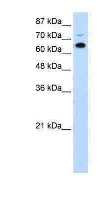 Western Blot: RBM46 Antibody [NBP1-80475] - Jurkat cell lysate, Antibody Titration: 0.2-1 ug/ml