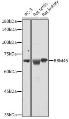 Western Blot: RBM46 Antibody [NBP2-94713] - Western blot analysis of extracts of various cell lines, using RBM46 antibody (NBP2-94713) at 1:1000 dilution. Secondary antibody: HRP Goat Anti-Rabbit IgG (H+L) at 1:10000 dilution. Lysates/proteins: 25ug per lane. Blocking buffer: 3% nonfat dry milk in TBST. Detection: ECL Basic Kit. Exposure time: 5s.