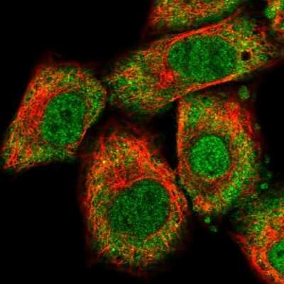 Immunocytochemistry/Immunofluorescence: RBM47 Antibody [NBP1-83664] - Staining of human cell line A549 shows localization to nucleoplasm & cytosol. Antibody staining is shown in green.