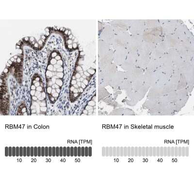 Immunohistochemistry-Paraffin: RBM47 Antibody [NBP1-83664] - Staining in human colon and skeletal muscle tissues using NBP1-83664 antibody. Corresponding RBM47 RNA-seq data are presented for the same tissues.