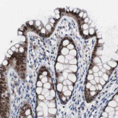 Immunohistochemistry-Paraffin: RBM47 Antibody [NBP1-83664] - Staining of human colon shows strong nuclear positivity in glandular cells.