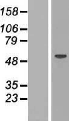 Western Blot: RBM47 Overexpression Lysate (Adult Normal) [NBP2-06732] Left-Empty vector transfected control cell lysate (HEK293 cell lysate); Right -Over-expression Lysate for RBM47.