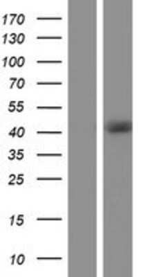 Western Blot: RBM4B Overexpression Lysate (Adult Normal) [NBP2-06119] Left-Empty vector transfected control cell lysate (HEK293 cell lysate); Right -Over-expression Lysate for RBM4B.