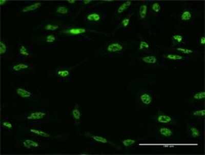 Immunocytochemistry/Immunofluorescence: RBM5 Antibody (3G6) [H00010181-M02] - Analysis of monoclonal antibody to RBM5 on HeLa cell . Antibody concentration 10 ug/ml.