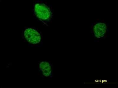 Immunocytochemistry/Immunofluorescence: RBM5 Antibody [H00010181-B01P] - Analysis of purified antibody to RBM5 on HeLa cell. (antibody concentration 10 ug/ml)
