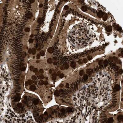 Immunohistochemistry-Paraffin: RBM5 Antibody [NBP1-83304] - Staining of human small intestine shows strong nuclear and cytoplasmic positivity in glandular cells.