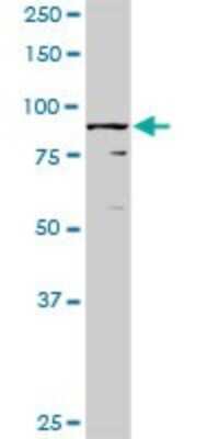 Western Blot: RBM5 Antibody [H00010181-D01P] - Analysis of RBM5 expression in human placenta.