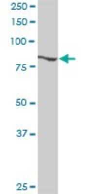 Western Blot: RBM5 Antibody [H00010181-D01P] - Analysis of RBM5 expression in mouse kidney.