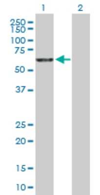 Western Blot: RBM5 Antibody [H00010181-D01P] - Analysis of RBM5 expression in transfected 293T cell line by RBM5 polyclonal antibody.Lane 1: RBM5 transfected lysate(61.50 KDa).Lane 2: Non-transfected lysate.