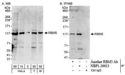 Western Blot: RBM5 Antibody [NBP1-26613] - Whole cell lysate from HeLa, 293T and mouse NIH3T3 cells. RBM5 was also immunoprecipitated by another rabbit anti-RBM5 antibody.