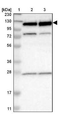 Western Blot RBM5 Antibody