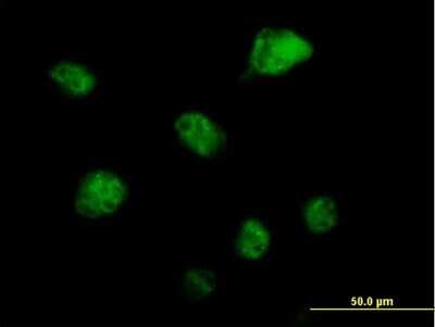 Immunocytochemistry/Immunofluorescence: RBM6 Antibody [H00010180-B01P] - Analysis of purified antibody to RBM6 on HeLa cell. (antibody concentration 10 ug/ml)
