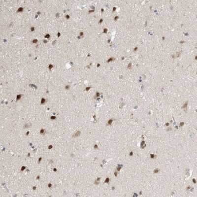 Immunohistochemistry-Paraffin: RBM6 Antibody [NBP1-89376] - Staining of human cerebral cortex shows strong nuclear positivity in neurons.