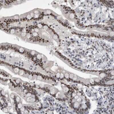 Immunohistochemistry-Paraffin: RBM6 Antibody [NBP1-89376] - Staining of human colon shows strong nuclear positivity in glandular cells.
