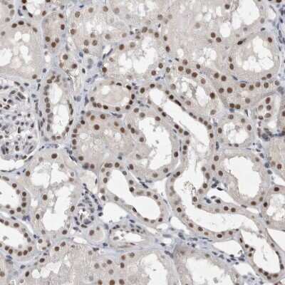 Immunohistochemistry-Paraffin: RBM6 Antibody [NBP1-89376] - Staining of human kidney shows strong nuclear positivity in cells in tubules.