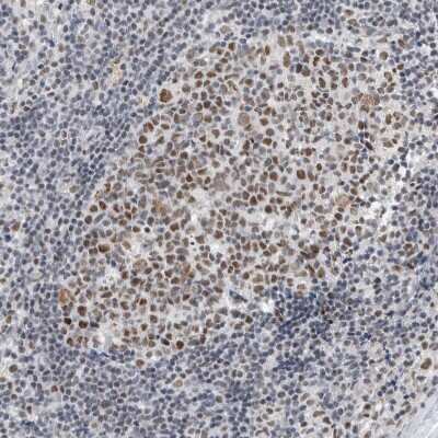 Immunohistochemistry-Paraffin: RBM6 Antibody [NBP1-89376] - Staining of human lymph node shows strong nuclear positivity in germinal center cells.