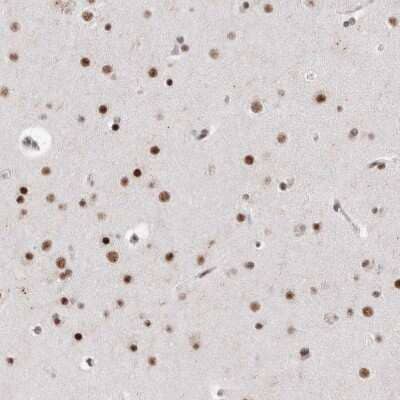 Immunohistochemistry-Paraffin RBM6 Antibody