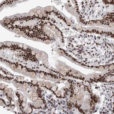 Immunohistochemistry-Paraffin RBM6 Antibody