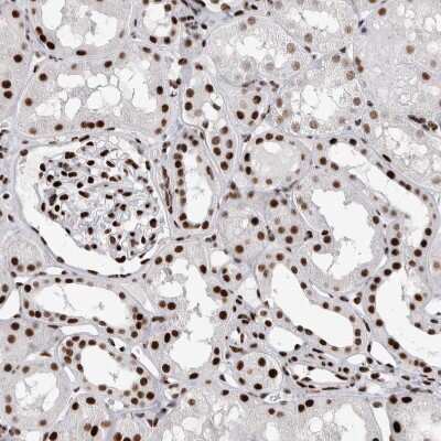 Immunohistochemistry-Paraffin RBM6 Antibody