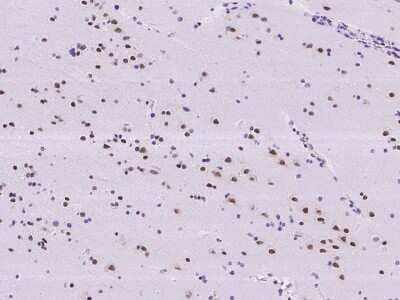 Immunohistochemistry-Paraffin: RBM6 Antibody [NBP2-97851] - Immunochemical staining of human RBM6 in human brain with rabbit polyclonal antibody at 1:500 dilution, formalin-fixed paraffin embedded sections.