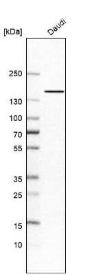 Western Blot: RBM6 Antibody [NBP1-89376] - Analysis in human cell line Daudi.