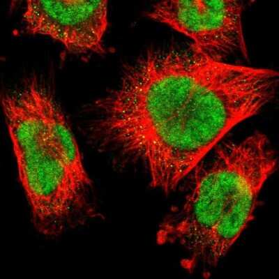 Immunocytochemistry/ Immunofluorescence RBM7 Antibody - BSA Free