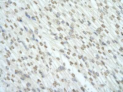 Immunohistochemistry: RBM7 Antibody [NBP1-57429] - Human Heart cell Cellular data: cardiac cell of renal tubule Antibody Concentration: 4.0-8.0 ug/ml Magnification: 400X.