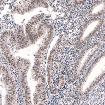 Immunohistochemistry-Paraffin RBM7 Antibody - BSA Free