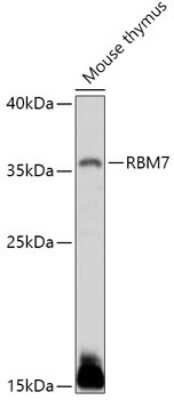 Western Blot: RBM7 Antibody [NBP2-94284] - Analysis of extracts of Mouse thymus, using RBM7 at 1:1000 dilution.Secondary antibody: HRP Goat Anti-Rabbit IgG (H+L) at 1:10000 dilution.Lysates/proteins: 25ug per lane.Blocking buffer: 3% nonfat dry milk in TBST.Detection: ECL Basic Kit .Exposure time: 180s.