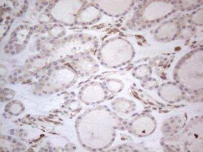 Immunohistochemistry: RBMS1 Antibody (OTI2H1) [NBP2-45533] - RBMS1 Antibody (2H1) [NBP2-45533] - Analysis of Human thyroid tissue. (Heat-induced epitope retrieval by 1mM EDTA in 10mM Tris buffer (pH8.5) at 120C for 3 min)