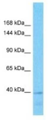 Western Blot: RBMXL1 Antibody [NBP3-09885] - Western blot analysis of RBMXL1 in Human 721_B Whole Cell. Antibody dilution at 1ug/ml