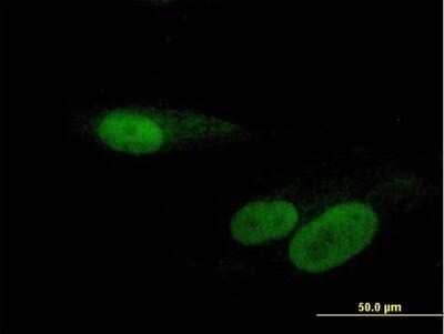 Immunocytochemistry/Immunofluorescence: RBMY1F Antibody [H00159163-B01P] - Analysis of purified antibody to RBMY1F on Hs 181.Tes cell. (antibody concentration 10 ug/ml)